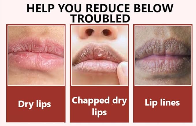 Sugar Lip Scrub - Gentle Lip Care Lip Exfoliator & Moisturizer - Exfoliating Lip Scrubber for Dry Lips-VivaGrace Women