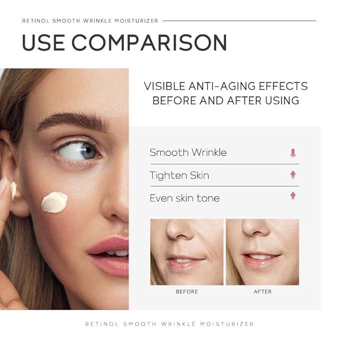 Anti Aging Skin Care Set, 1% Retinol Dark Spot Remover for Face with Face Serum & Moisturizer, Travel Size Skincare Set for Women, Reduce Wrinkles, Firm & Hydrate for All Skin Types-VivaGrace Women