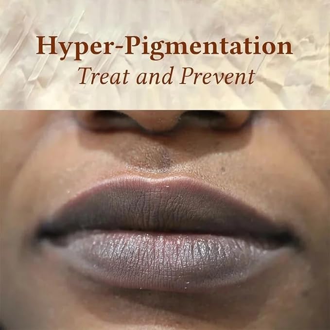 2PCS Handmade Plant lip balm Pink Lips Serum Brighten Dark Lips Bleaching Essence Lip Balm Repair Fine Lines Brighten Moisture Exfoliator Lip Care (Yellow)-VivaGrace Women