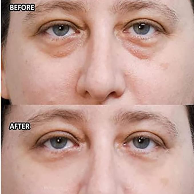 Wow-IT Instant Under Eye Cream,Ream For Eye Bags,Remove Under Eye Bags Instantly,Anti-Wrinkle Eye Cream，Helps To Instantly Reduce The Puffy Eye Look (3PCS)-VivaGrace Women