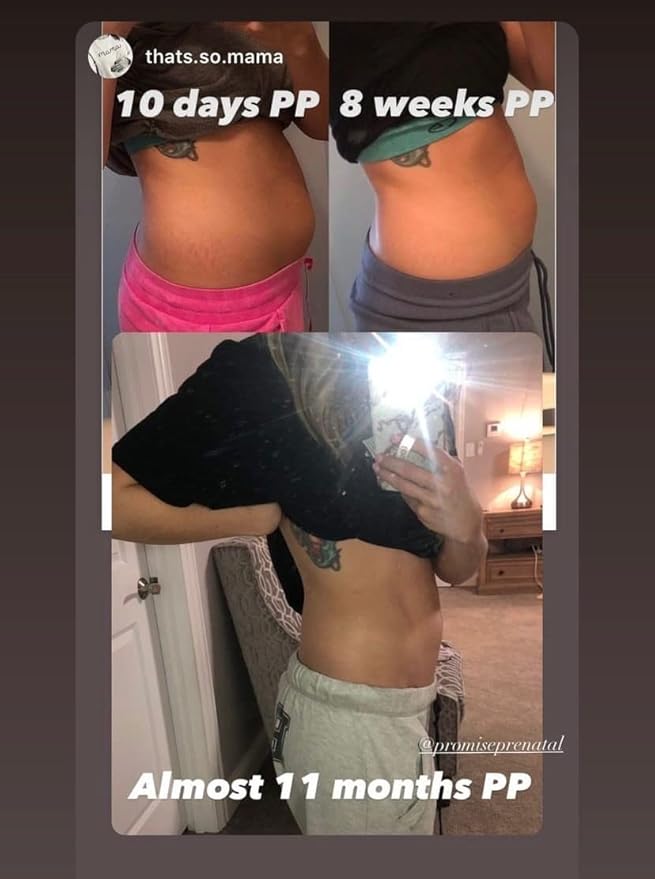 Promise Stretch Mark Prevention Bump Oil, Defense + Repair, Clean Pregnancy Skincare, Non-Toxic, Pregnancy Belly Oil, Vegan, Fast Drying-VivaGrace Women