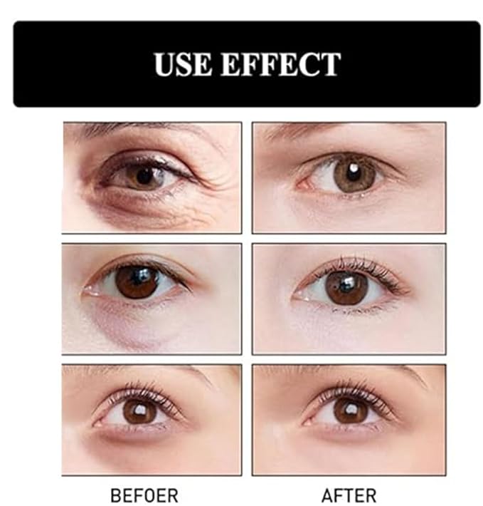 Berbax Instant Firm Eye Tightener, Berbax Eye Bag Cream, Berbax Dark Circle Eye Cream, Berbax Brightening Firming Eye Cream, Berbax Instant Firming Anti-Aging Eye Cream (1.05OZ)-VivaGrace Women