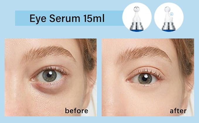 5% Caffeine Eye Serum, Under Eye Roller Cream for Dark Circles and Puffiness with 360°Massage Ball Reduce Wrinkles and Fine Lines，Bags Under Eyes，15ML-VivaGrace Women