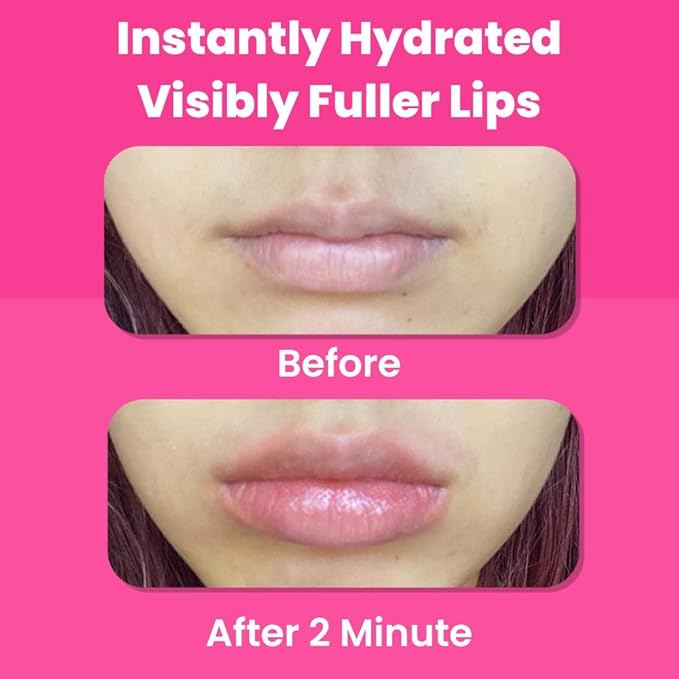 One Minute Lip Plumper Patch - Instant Lip Hydration Patch with Hyaluronic Acid & Collagen Microvector from Tarel Laboratory-VivaGrace Women