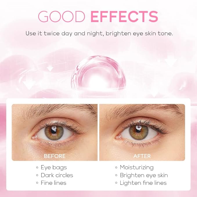 AKARY Cherry Blossom Eye Cream with Hyaluronic Acid, Lightweight Skincare Eye Cream for Dark Circles and Puffiness, Hydrating Under Eye Cream for All Skin Types, Cruelty-Free & Fragrance-Free-VivaGrace Women