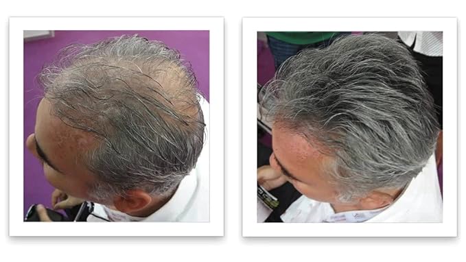 Trial Size - Make Thin Hair Look 10X Fuller. Eliminate Bald Spot and Thinning Hair Instantly. All-Natural Hair Concealer. Salt & Pepper - Light