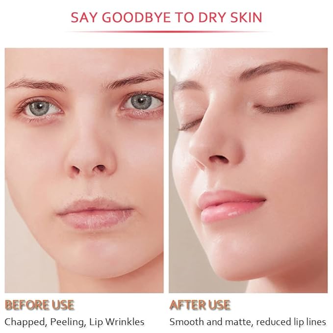 20Pcs Moisturizing Restores Moisture Lip Mask for Dry Lips and Lip Lines Overnight Lip Care, Gel Treatment Plumping Lips Mask (Red)-VivaGrace Women