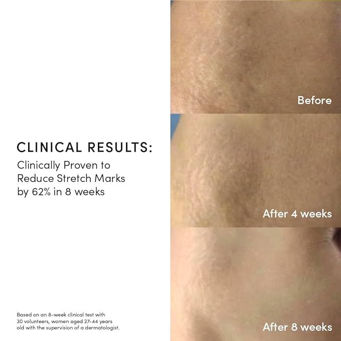 Evereden Golden Belly Serum, 1.7 fl oz. | Clean & Vegan Women's Belly Oil for Pregnancy and Postpartum | Clean Maternity Skincare | Non-Toxic Stretch Mark Oil-VivaGrace Women