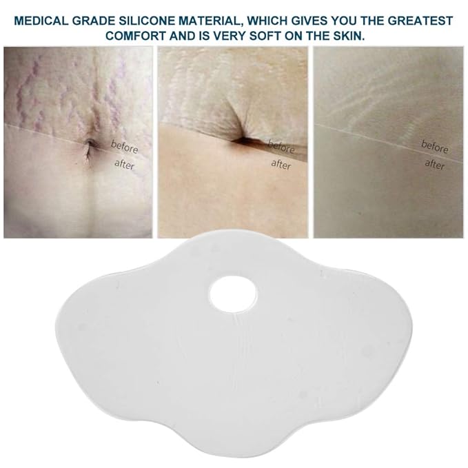 Scar Removal Sheet, Reusable Silicone Anti-Wrinkle Belly Stomach Pads Stickers Stretch Marks Removal Skin Care, Health and Beauty Supplies-VivaGrace Women