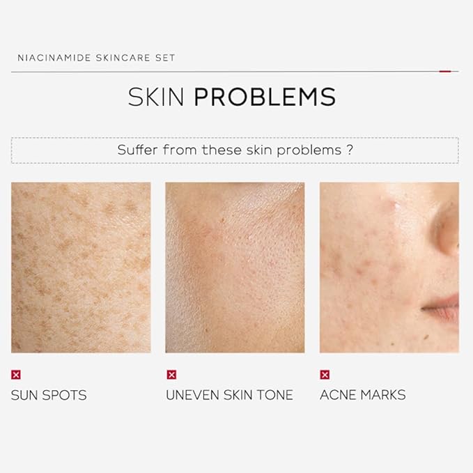 Niacinamide Skincare Set: 4pcs Beauty Kit with Cleanser, Toner, Serum, & Facial Cream - Hydrates & Evens Skin Tone - TSA-Friendly Travel Sizes, Perfect Gift for Women, Moms, & Teens-VivaGrace Women