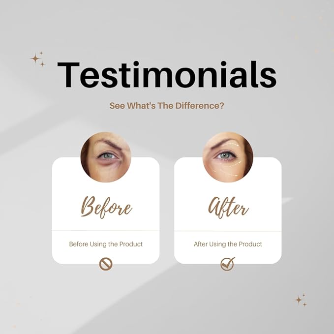 Eye Cream Peptide Snail Mucin Filtrates! NIACINAMIDE- Moisturizer, Brightening, Reduce Dark Circles & Wrinkles, Fine Lines, Sign of Aging. Made in Korea Skincare!-VivaGrace Women