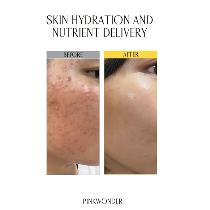 PINKWONDER USDA Organic Jojoba Oil (6.76oz, Jojoba Toner)-VivaGrace Women