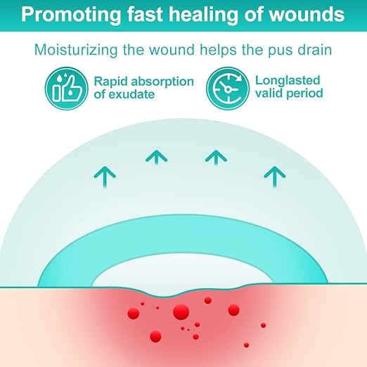 Dimora Hydrocolloid Dressing 4" x 4" for Wound Care, 10 Pack Large Patch Bandages with Self-Adhesive for Bedsore, Burn, Blister, Acne Care, Super Absorbent for Fast Healing-VivaGrace Women