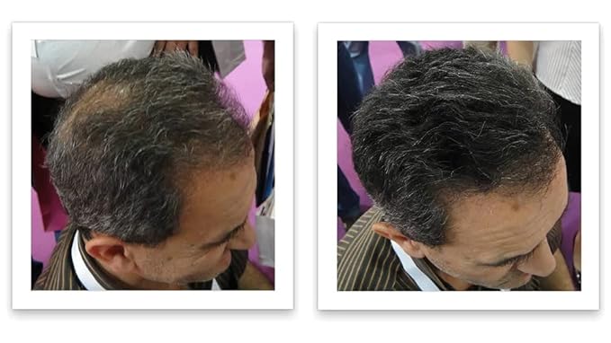 Trial Size - Eliminate Bald Spot and Thinning Hair Instantly. Make Thin Hair Look 10X Fuller. All-Natural Hair Thickening Fiber. Salt & Pepper - Dark-VivaGrace Women