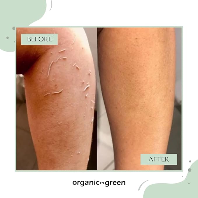 Organic to Green Premium Exfoliating Mitt for Body (2pc) – 100% Vegan Viscose Traditional Body Scrub Washcloth – Body Exfoliator (Green)-VivaGrace Women