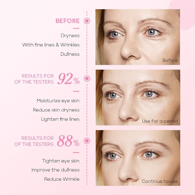 AKARY Cherry Blossom Eye Roller Serum Eye Moisturizer, Deep Hydration Eye Serum with Caffeine and Sodium Hyaluronate, Under Eye Cream to Reduce Dark Circles, Fine Lines, Smoothing Skin Care Treatment-VivaGrace Women