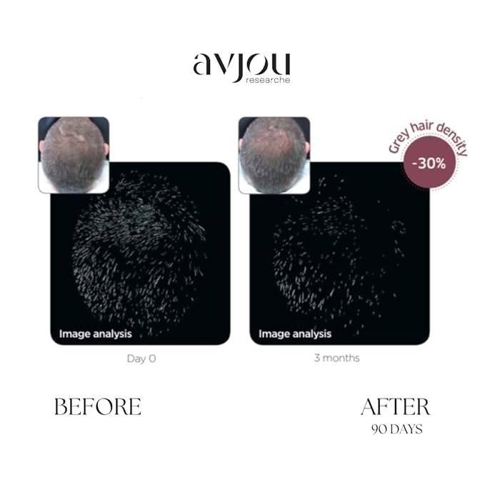 Avjou Researche™ Scalp Serum – Thicker, Fuller-Looking Hair + Targets Visible Signs of Premature Greying – 3 Patented Ingredients – Backed by Cosmetic Science – Oil-Free, All Hair Types, 1.7 oz-VivaGrace Women