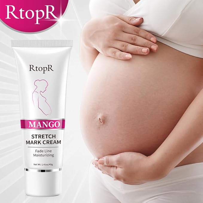 RtopR Mango Stretch Mark Cream for Pregnancy, Stretch Mark Repair Cream, Fade Line, Moisturizing and Non-Greasy, Safe to Use When Pregnant-VivaGrace Women