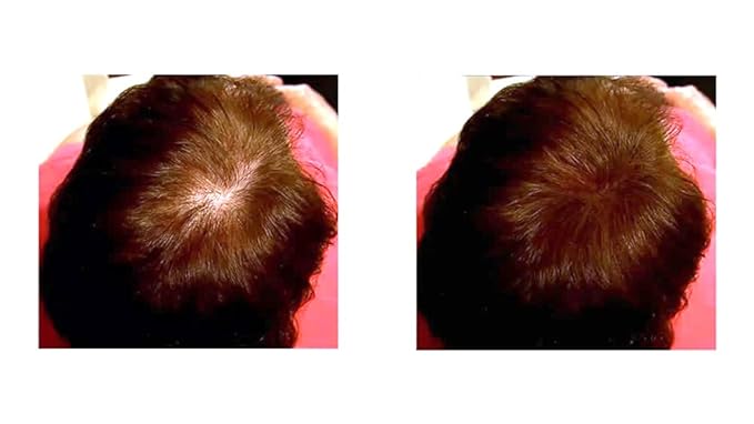 Thinning Hair Solution - All-Natural, Plant-Based Fibers For Fuller, Thicker Appearance. Instantly Covers Bald Spots. Auburn (red/ginger hair). Trial Size, 10-Day Supply-VivaGrace Women