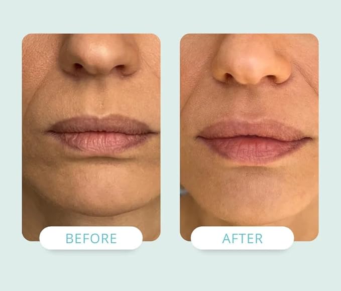 NADIA Lip Renewal Cream with NAD+ 10 ml / 0.34 fl oz (Made in USA)-VivaGrace Women