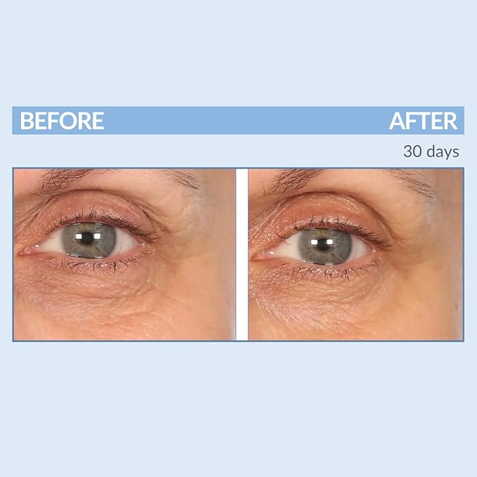 Serious Skincare - Eyetality Morning Total Eye Care Cream - For Lines, Wrinkles, Under Eye Puffiness and Dark Circles - Coffee Bean Extract - Vitamin C - Pomegranate - 0.5 oz-VivaGrace Women