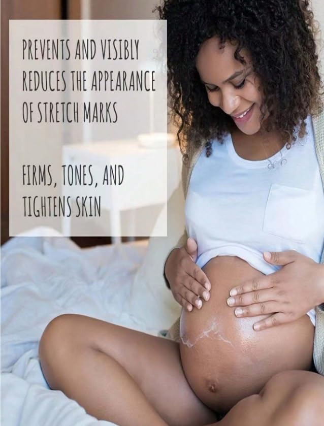 TRSTAY Stretch Mark Treatment Stretch Mark Cream (5, Grams)-VivaGrace Women