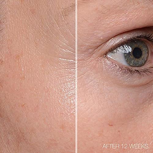 MD Complete Total Eye Treatment | Anti-Aging Hydrating Skin Renewal Eye Treatment | with Peptides, Vitamins C & E and Hyaluronic Acid for Wrinkles, Fine Lines and Crows Feet 0.5 fl oz-VivaGrace Women