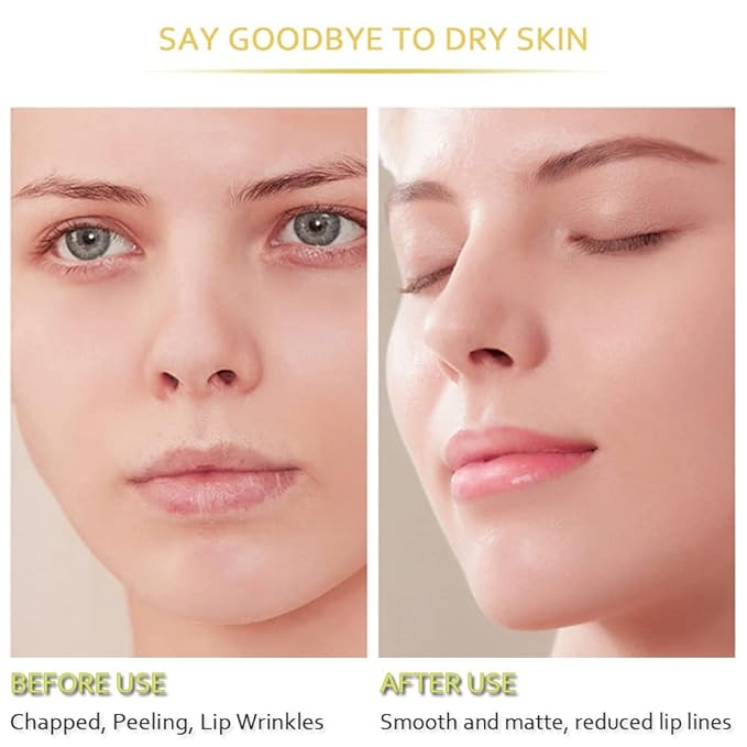 20Pcs Moisturizing Lip Mask, Restores Moisture Lip Care Mask for Dry Lips and Lip Lines Lips Overnight Lip Care, Gel Treatment Lip Masks Plumping Lips Mask (Yellow)-VivaGrace Women