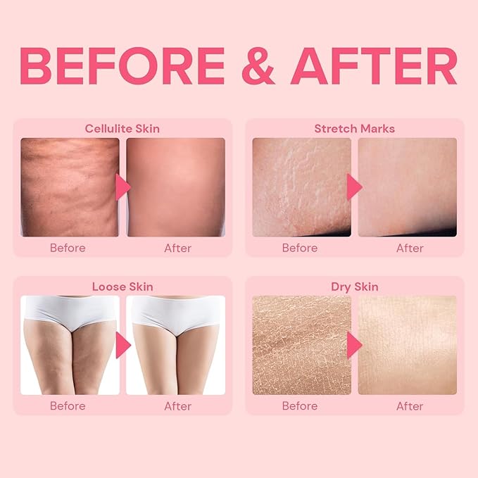 Anti Cellulite Body Firming Cream: Cellulite Remover for Legs & Inner Thigh- Skin Tightening Lotion for Womens' Booty, Stomach & Belly with Acetyl Hexapeptide-8 & Caffeine, 100 ML-VivaGrace Women