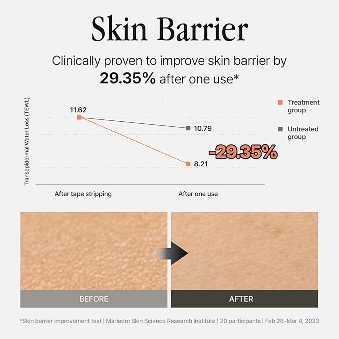 Silver Frost Mist - Facial Barrier Toner Spray with 80% Witch Hazel Water, Cica for Skin Barrier Repair, Recovery Mist for Sensitive Skin, Dewy Hydration, Korean Skin Care (3.38 fl oz)-VivaGrace Women