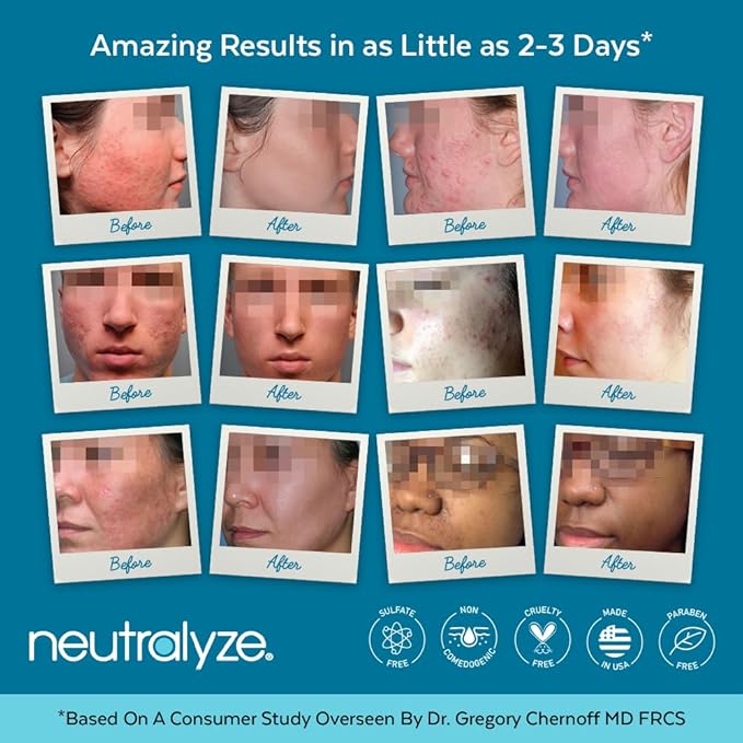 Moderate To Severe Acne Treatment Kit 2.0 (Clearing Serum & Synergyzer)-VivaGrace Women