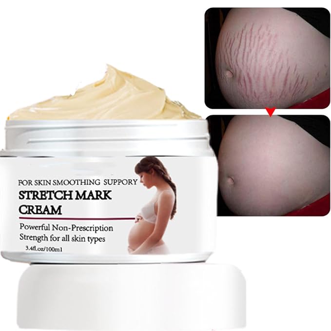 Stretch Mark Prevention Cream for Pregnancy, Stretch Mark Cream Remover, Stretch Mark Lotion for Pregnancy, Tummy Butter for Stretch Marks Pregnancy, Shea Butter Stretch Mark Removal Cream-VivaGrace Women