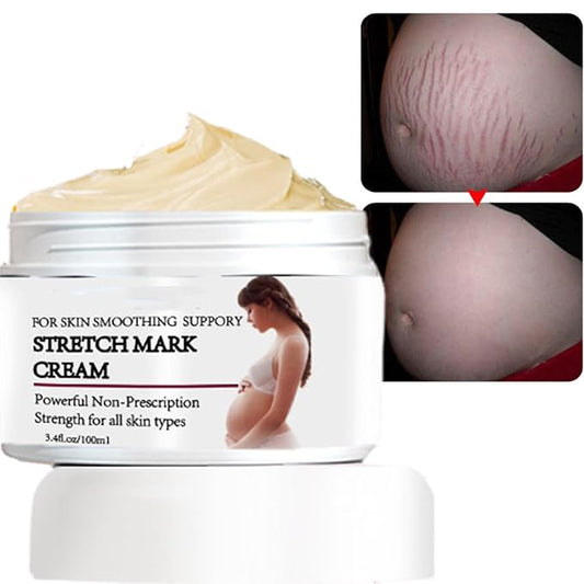 Stretch Mark Prevention Cream for Pregnancy, Stretch Mark Cream Remover, Stretch Mark Lotion for Pregnancy, Tummy Butter for Stretch Marks Pregnancy, Shea Butter Stretch Mark Removal Cream-VivaGrace Women