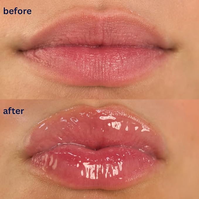 Endless Skin - Daydream - Natural Vanilla Flavor Lip Balm with Jojoba Oil, Hyaluronic Acid and Squalane - Ultra Glossy Finish that Nourishes and Hydrates Your Lips - Vegan and Paraben Free - 15ml-VivaGrace Women