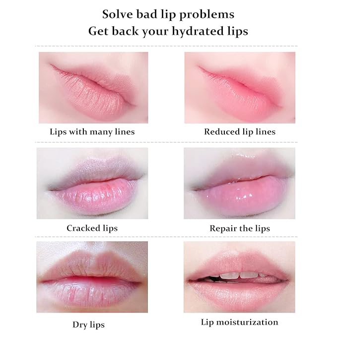 20Pcs Lip Mask,Pink Moisturizing Plumping Lip Masks Overnight,Pink Lip Mask Gel Treatment Lip Masks for Dry Lips Plump Lip Collagen Overnight Sleeping Lip Mask Pads Patches（Pink）-VivaGrace Women