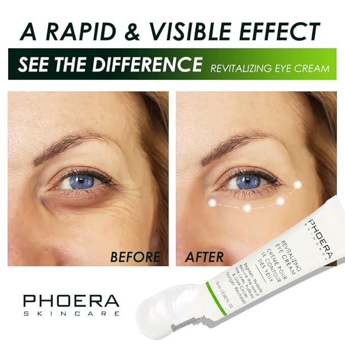 Phoera Revitalizing Eye Cream Brighten Hydrate Reduce The Fine Lines, Dark Circle Wrinkles And Puffiness For Men And Women Skin Loving Ingredients Apply In Morning And At Night-VivaGrace Women
