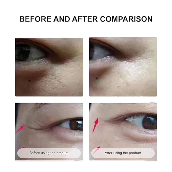 Under Eye Mask Wrinkle Patches, Under Eye Mask Amino Acid & Collagen,Eye Masks for Dark Circles and Puffiness,Eye Wrinkle Pads & Patches-VivaGrace Women