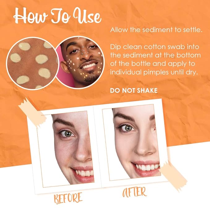 Bye Bye Blemish Dark Spot Lotion Vitamin C | Assists with Drying Blemishes And Brightening Skin | Fast Acting Solution | 1 Fl. Oz.-VivaGrace Women