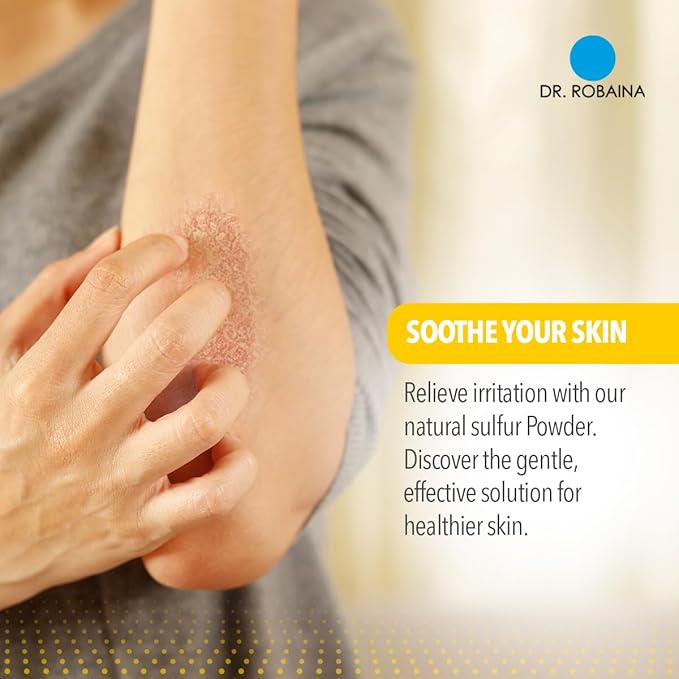 Dr. Robaina Sulfur Balsam Lotion – Lightweight Moisturizer for Dry, Flaky & Itchy Skin – Calms Redness, Supports Skin Barrier & Locks Hydration – Shea Butter & Tea Tree – 8 fl oz, USA Made-VivaGrace Women