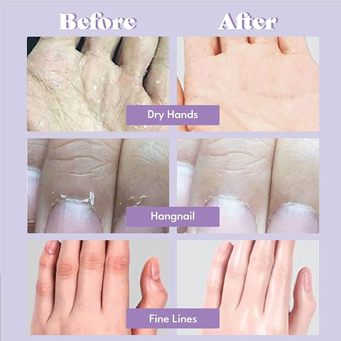 Catherine Muller Floral Hand Mask 8 Pairs, Moisturizing Gloves for Dry Hands with Elder Flower & CICA, Repairing and Nourishing Hand Care Treatment for Cracked, Rough, and Dry Skin-VivaGrace Women