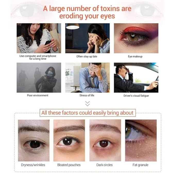 Under Eye Patches - 30 Pairs Collagen Eye Mask Eye Patches for Puffy Eyes and Dark Circles, Gel Under Eye Mask, Black-VivaGrace Women