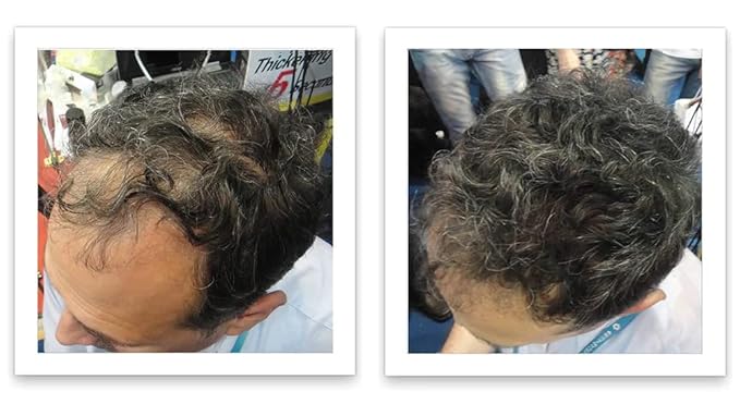 Trial Size - Eliminate Bald Spot and Thinning Hair Instantly. Make Thin Hair Look 10X Fuller. All-Natural Hair Thickening Fiber. Salt & Pepper - Dark-VivaGrace Women