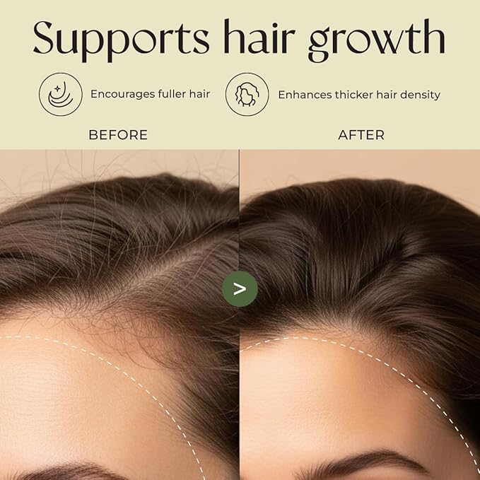 Gya Labs Rosemary & Castor Hair Growth & Styling Oil - 4 Fl Oz - Rosemary to Strengthen Hair - Protect & Tame Frizz, Dry Scalp - Hair & Scalp Hydration with 0.17 Fl Oz Deep Revival Argan Oil-VivaGrace Women