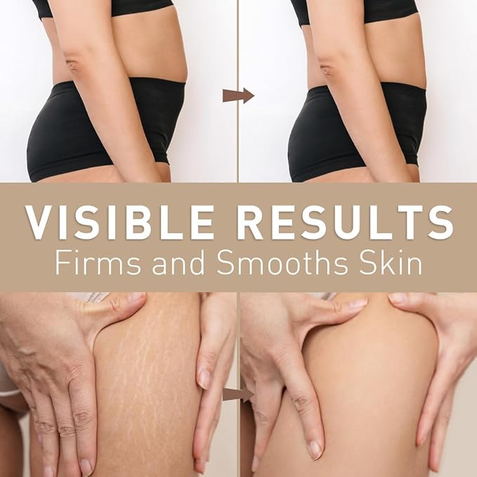 Belly Firming Cream: B Flat Skin Tightening Cream , Cellulite & Stretch Mark Reduction & Tummy Hips Cream & Body Firming for Stomach & Thighs & Arms – 3.38 Fl Oz-VivaGrace Women