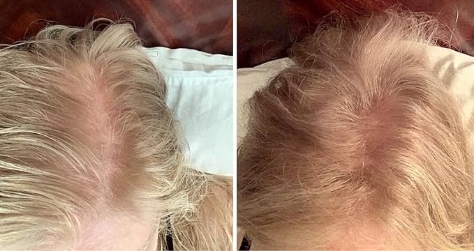 Hair Building Fibers. Cover Bald Spot and Thinning Hair. All-Natural, Plant-Based (Trial Size, 10-Day Supply). Golden Blonde-VivaGrace Women