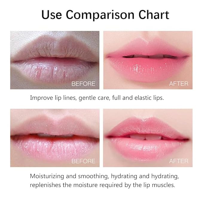 20Pcs Moisturizing/Plumping Lip Mask, Restores Moisture Mask for Dry Lips and Lines Overnight Care, Gel Treatment Masks (Pink)-VivaGrace Women