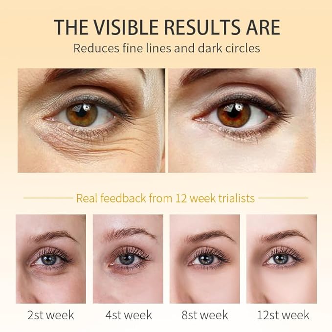 RtopR Mango Firming Eye Cream, Under Eye Cream for Dark Circles and Puffiness, Firm and Smooth the Look of Fine Lines, Smoothes the Skin Around the Eyes-VivaGrace Women