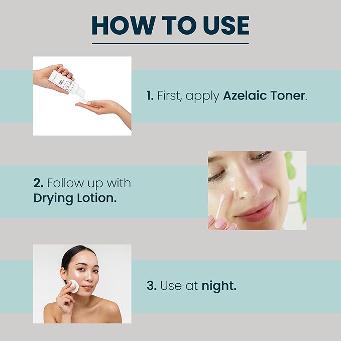 Azelaic Toner & Drying Lotion Duo - Face Treatment Set for Rosacea & Cystic Acne, Soothing Redness Relief, Shrinks Whiteheads & Pores | Normal to Oily Skin-VivaGrace Women