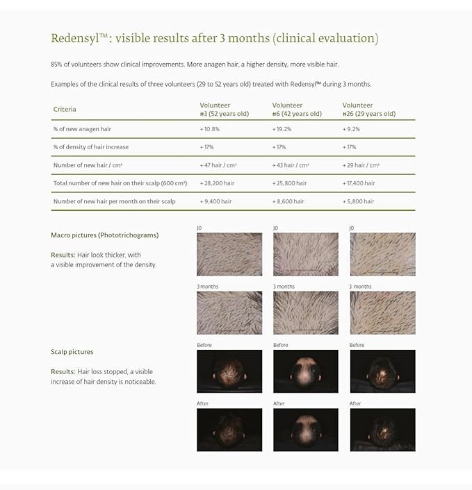 Avjou Researche™ Vitamin Mask – Supports the Look of Thicker, Fuller Hair – Vegan, Color & Keratin Safe, Hydrates & Strengthens with Redensyl™ – Designed for All Hair Types, 6 oz-VivaGrace Women