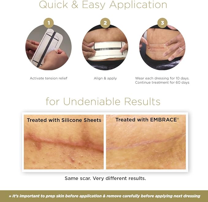 Embrace Active Scar Defense for New Tummy Tuck Scars, FDA-Cleared Extra-Large Silicone Scar Sheets, 30 Day Supply-VivaGrace Women
